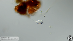 Vorticella infusionum