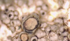 Lecanora pseudistera