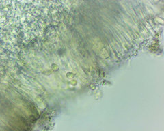 Lecanora pseudistera