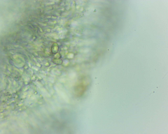 Lecanora pseudistera