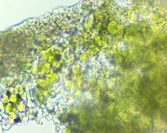 Lecanora pseudistera