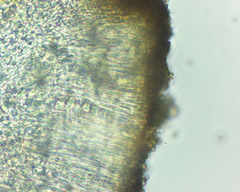 Lecanora pseudistera