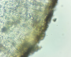 Lecanora pseudistera