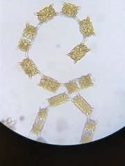 Odontella aurita