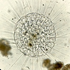 Actinosphaerium