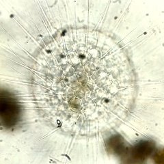 Actinosphaerium