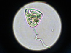 Vorticella