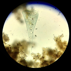 Stentor coeruleus