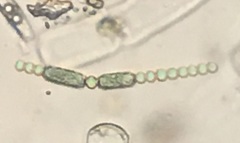Anabaena