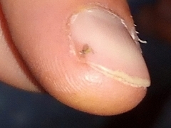 Phlebotominae