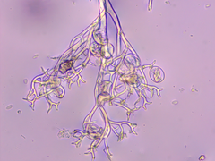 Peronospora conferta