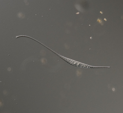 Amphileptus procerus