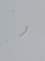 Anabaena
