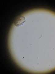 Anabaena