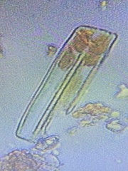 Fragilaria