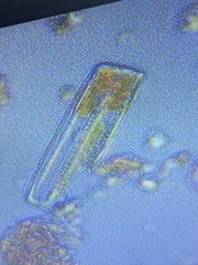 Fragilaria