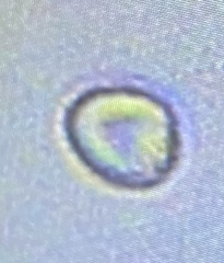 Cocconeis