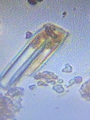 Fragilaria