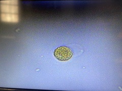 Heliozoa