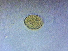 Heliozoa