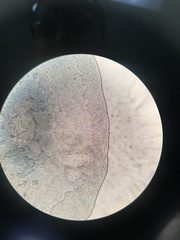 Saccharomyces cerevisiae
