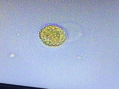 Heliozoa