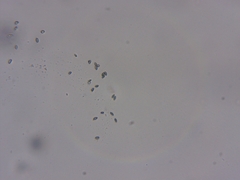 Mycocalicium subtile