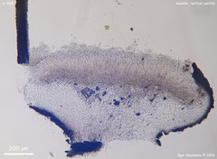 Tryblidiopsis magnesii