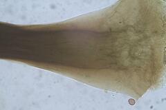 Collaria arcyrionema