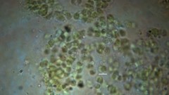 Chlorophyta