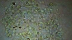 Chlorophyta