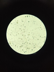 Aspergillus niger
