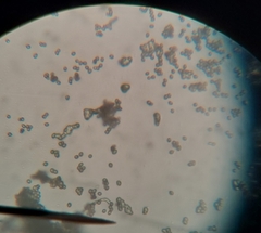 Sclerotinia sclerotiorum