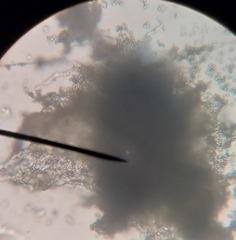 Sclerotinia sclerotiorum