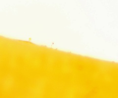 Dryopteris × triploidea