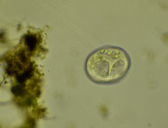 Vorticella
