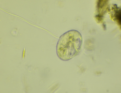 Vorticella