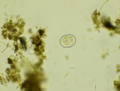 Vorticella