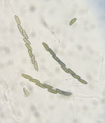 Rosellinia