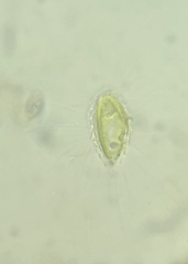 Mallomonas caudata