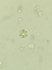 Coelastrum astroideum