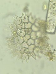 Pseudopediastrum boryanum
