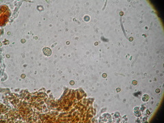 Chaenotheca brunneola