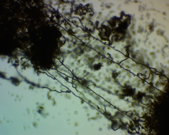 Arcyria cinerea