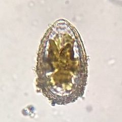Surirella