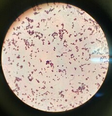 Micrococcus luteus
