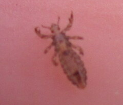 Pediculus humanus capitis