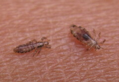 Pediculus humanus capitis