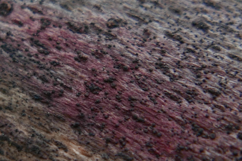 Leptospora