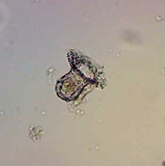 Tintinnopsis